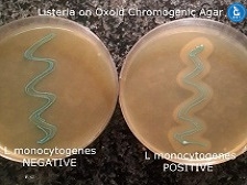 listera bacteria