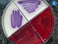 Salmonella typhi on Chromogenic and XLD agar